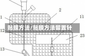 贴膜方法/贴膜方法留置针